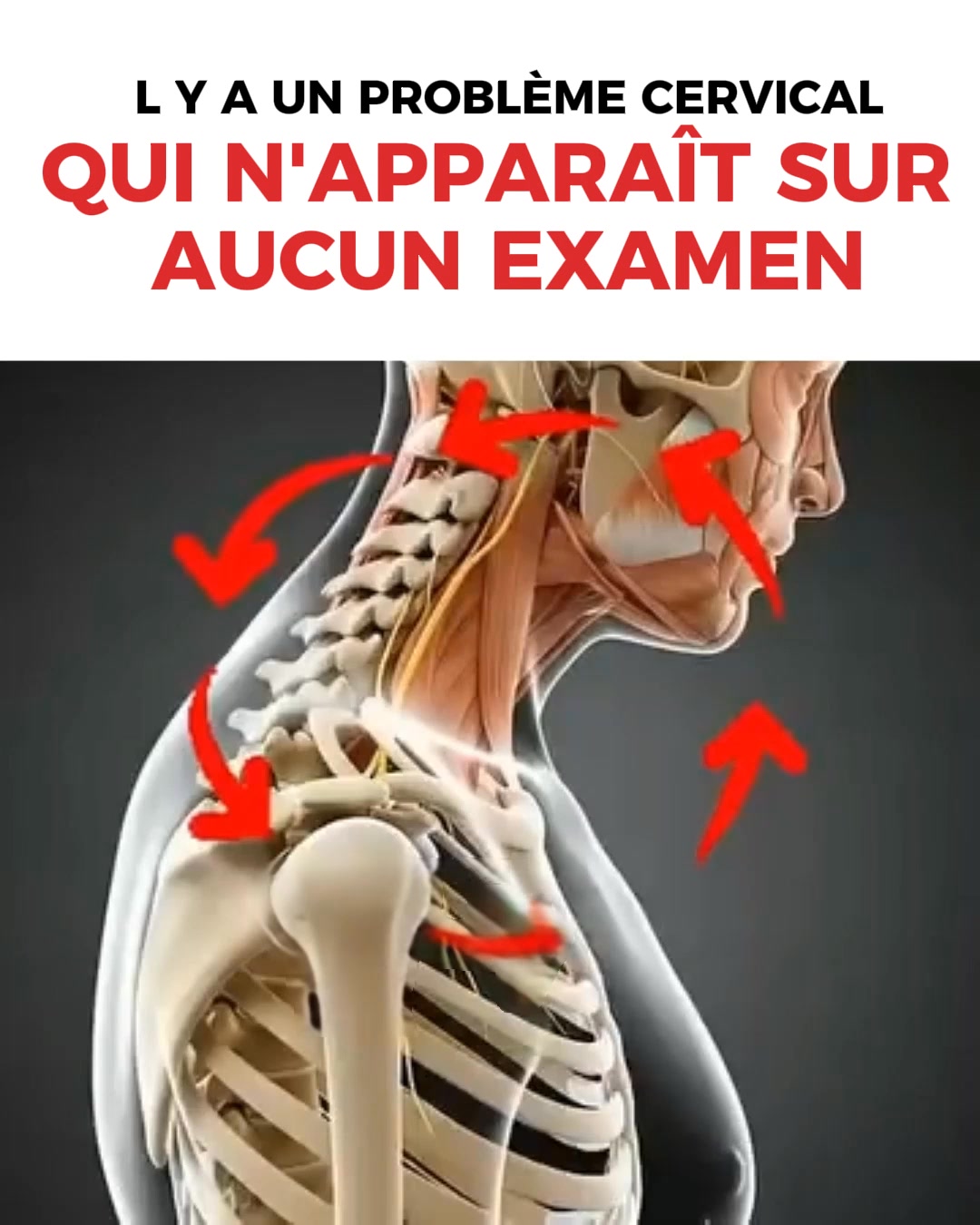 L'Erreur Que Tout le Monde Fait Avec la Tension Artérielle (Moi Aussi Je L'Ai Faite)
