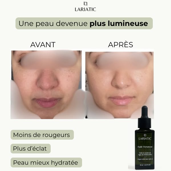 L'Huile Anti-âge N°1