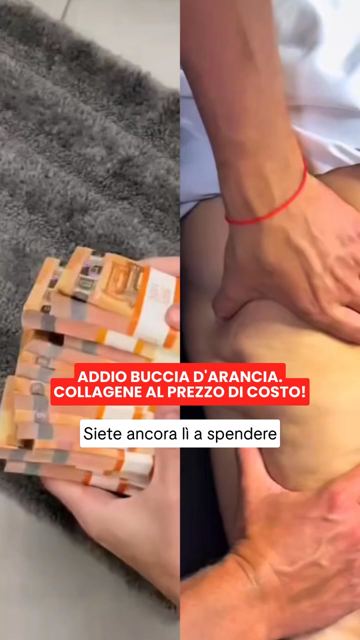 La cellulite non è solo grasso