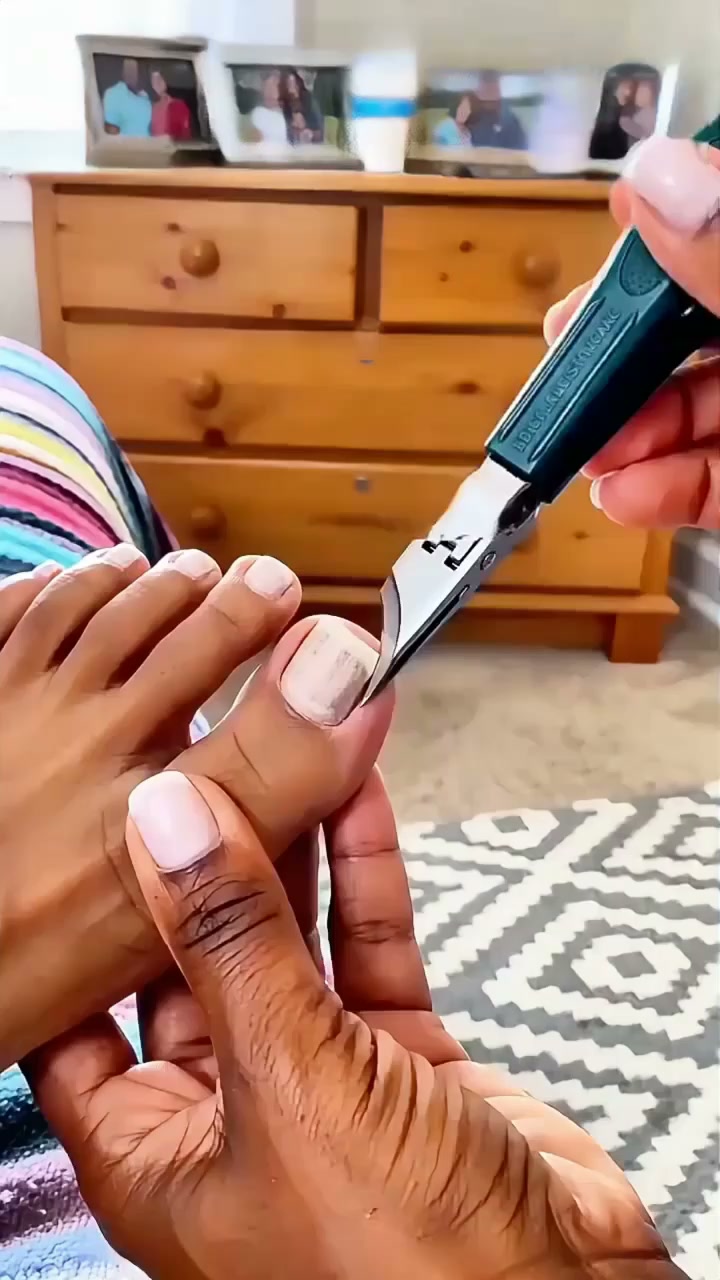 Comfort Starts With Healthy Nails