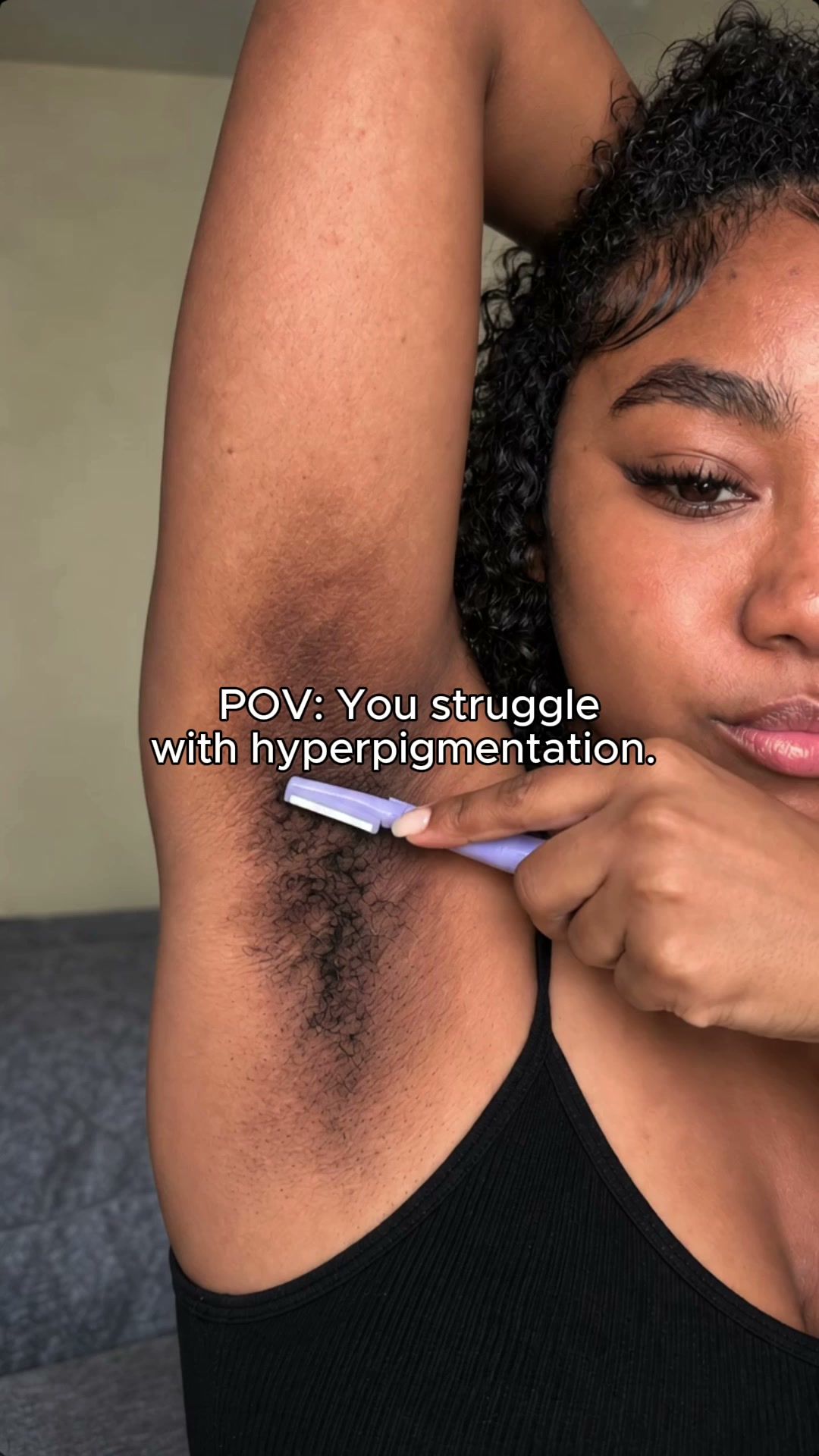 Kojic Acid for Stubborn Dark Armpits