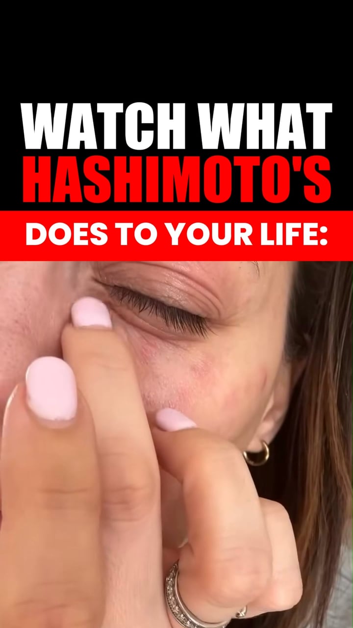 Fix your Thyroid, Naturally