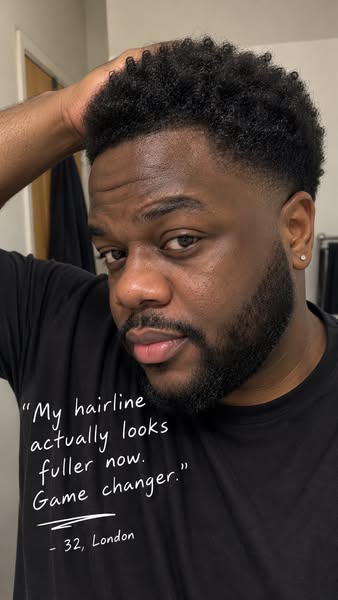 Take Control of Your Hairline Today
