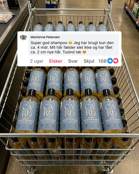 Farvel hårtab — goddag nyt hår