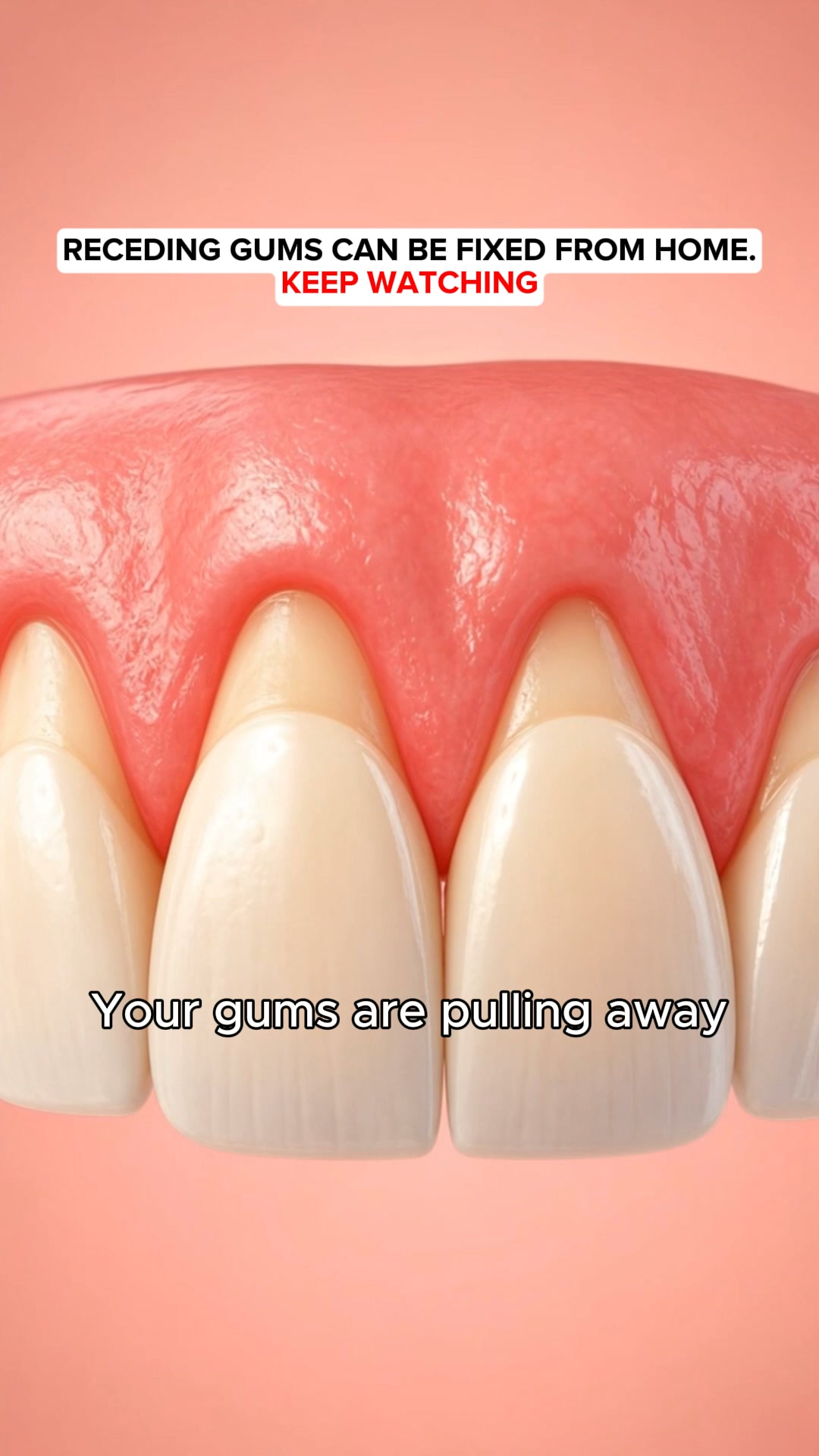 My Gums Kept Pulling Back
