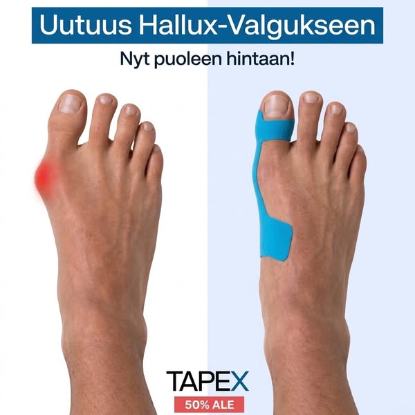 Hallux Valgus -korjausteippi