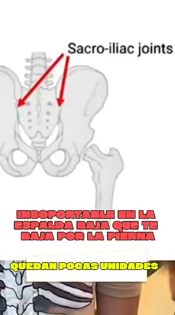 ¿ESE DOLOR EN LA CADERA Y ZONA LUMBAR TE ESTÁ AMARGANDO EL DÍA?