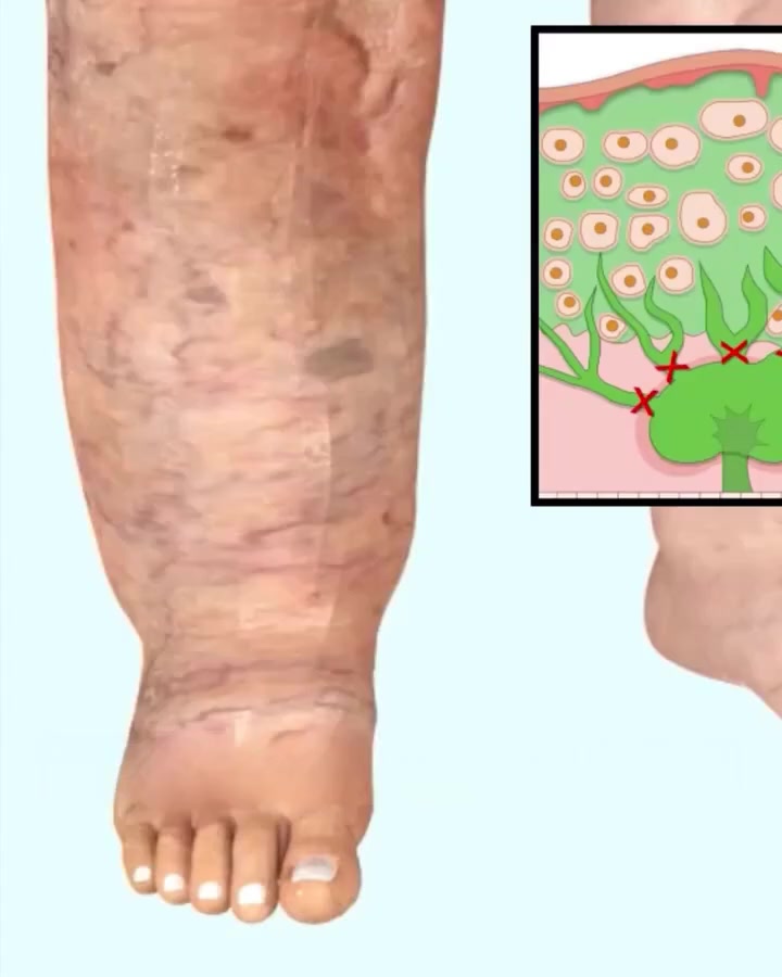 Il comfort che mancava alle tue gambe
