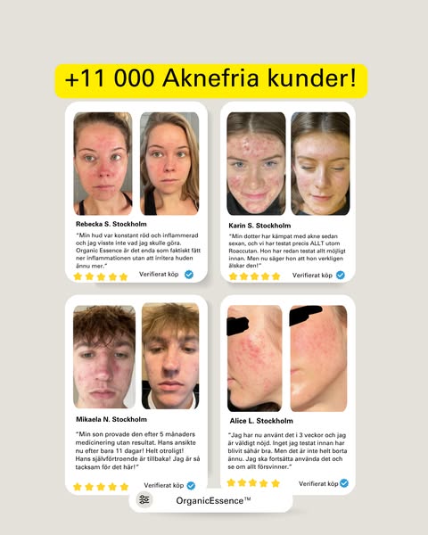 Hejdå finnar, hej ren hud
