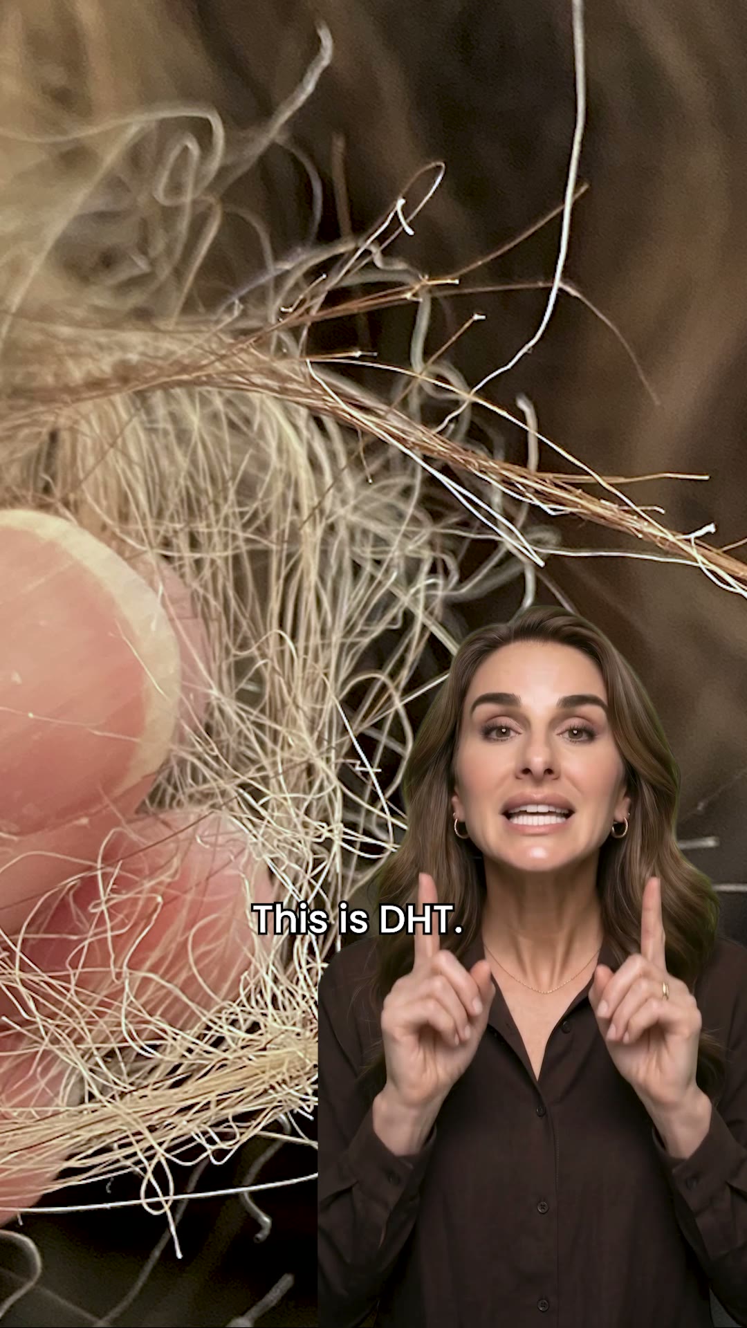 It's Not Breakage. The Follicle Is Getting Smaller.