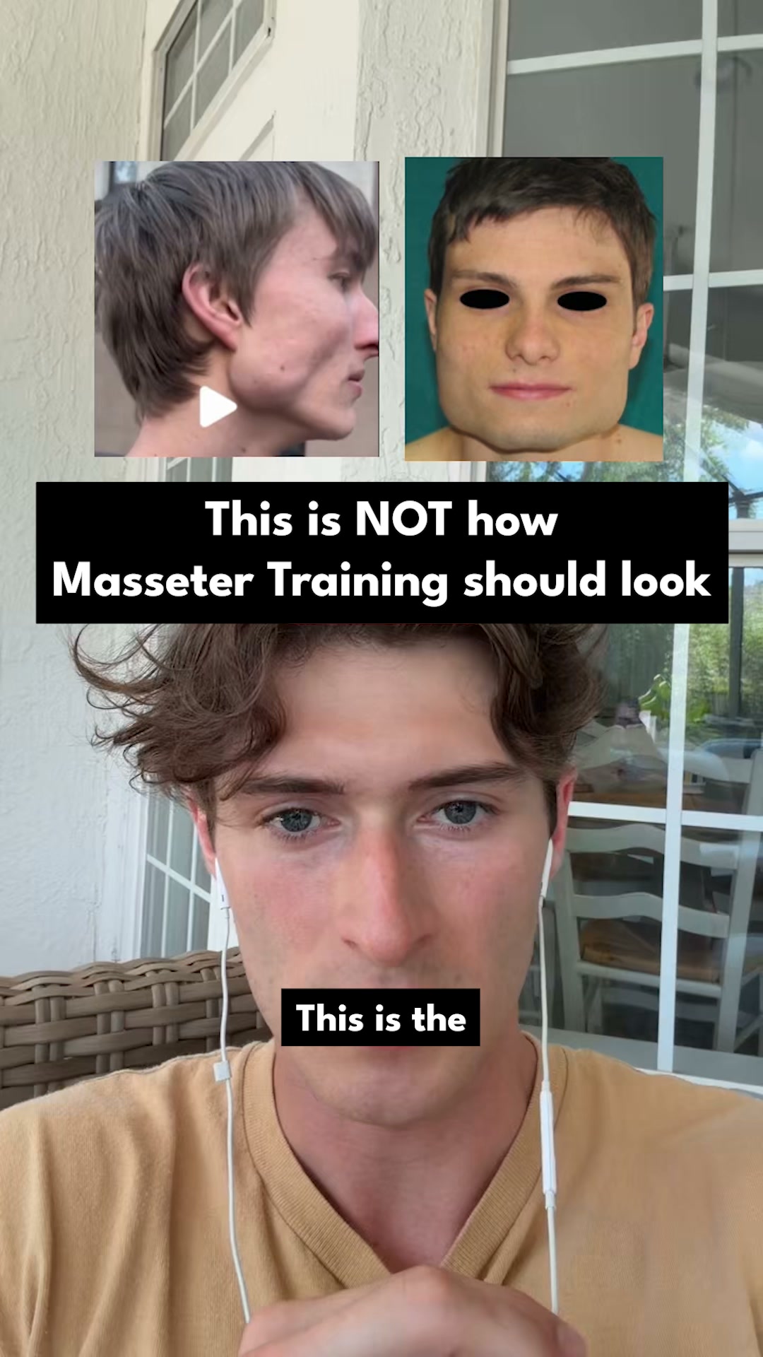 Natural Jawline Definition
