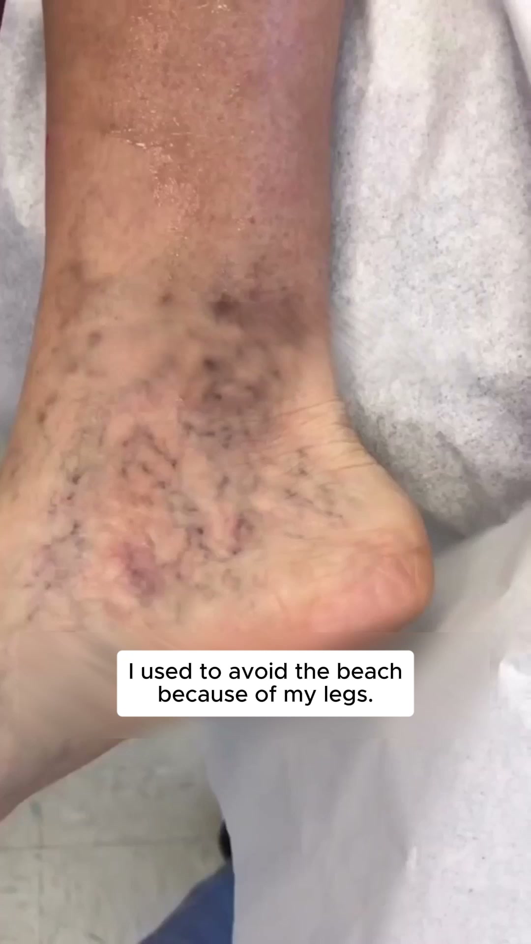 Tired of swollen, aching legs? FlowSocks™ offers the perfect solution with ease! 4.8/5