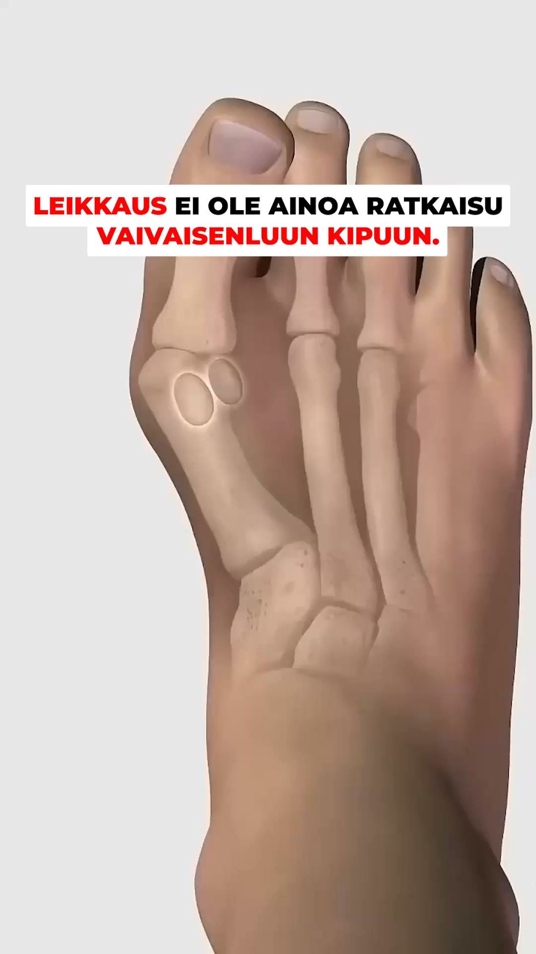 Tukea jaloille jokaisella askeleella