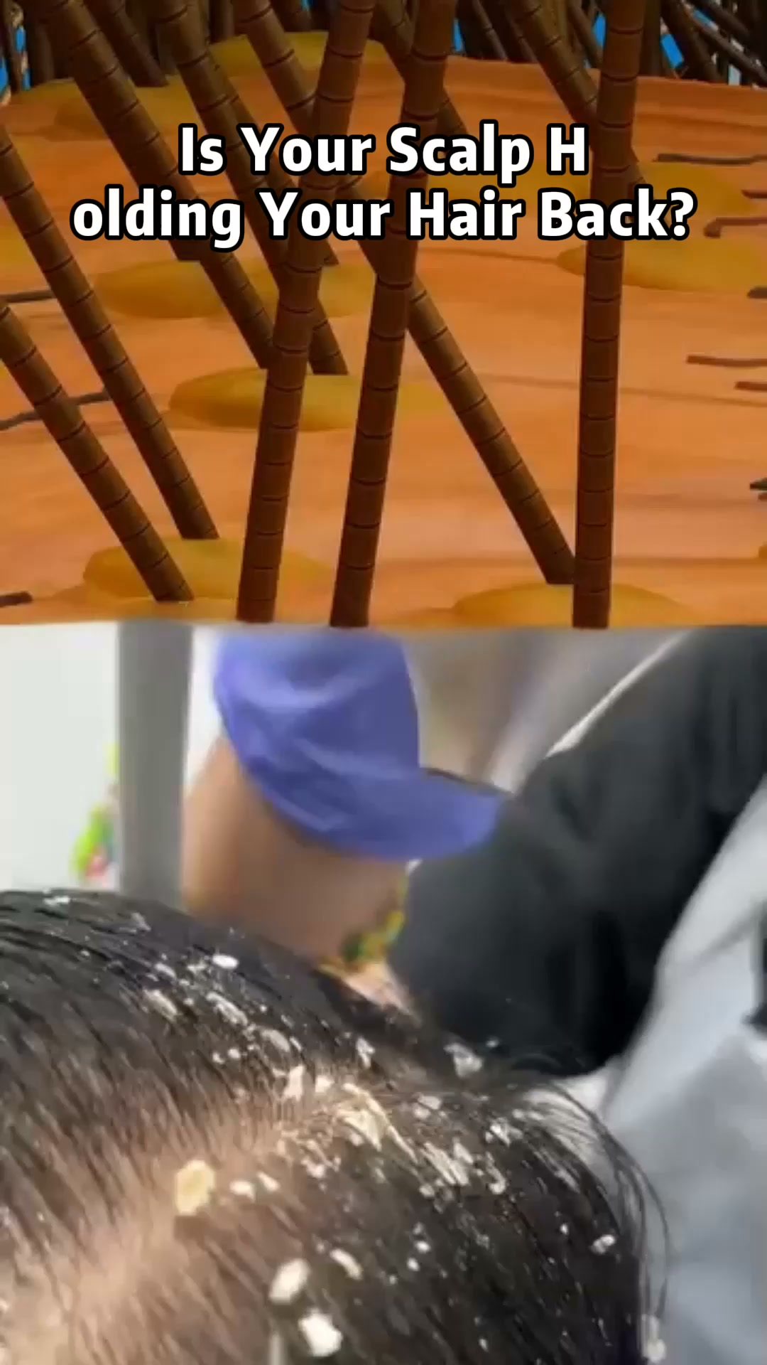 Nano Microneedle Delivery for Better Absorption & Healthier-Looking Hair.