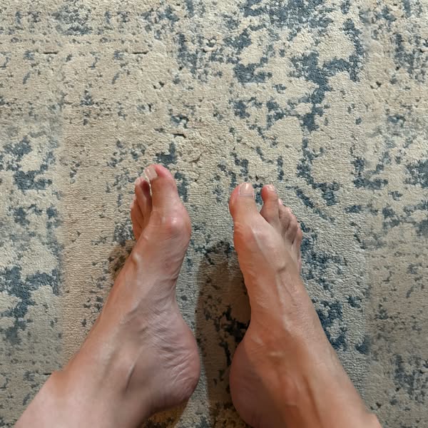 Five Years Of Gout Fear