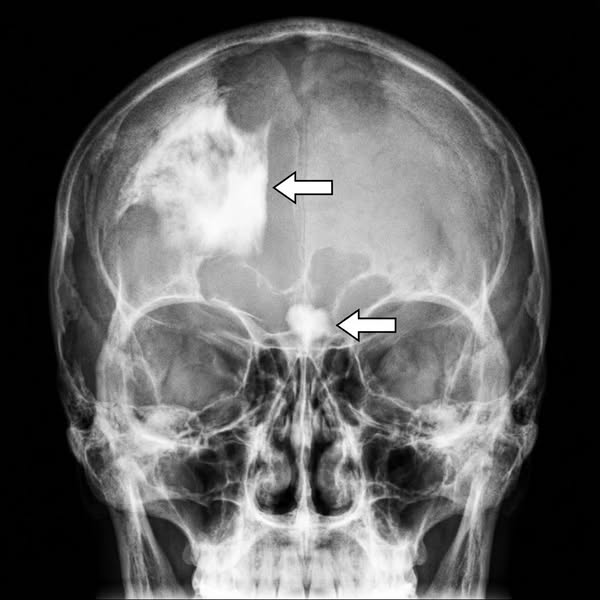 Protect your brain before it's too late