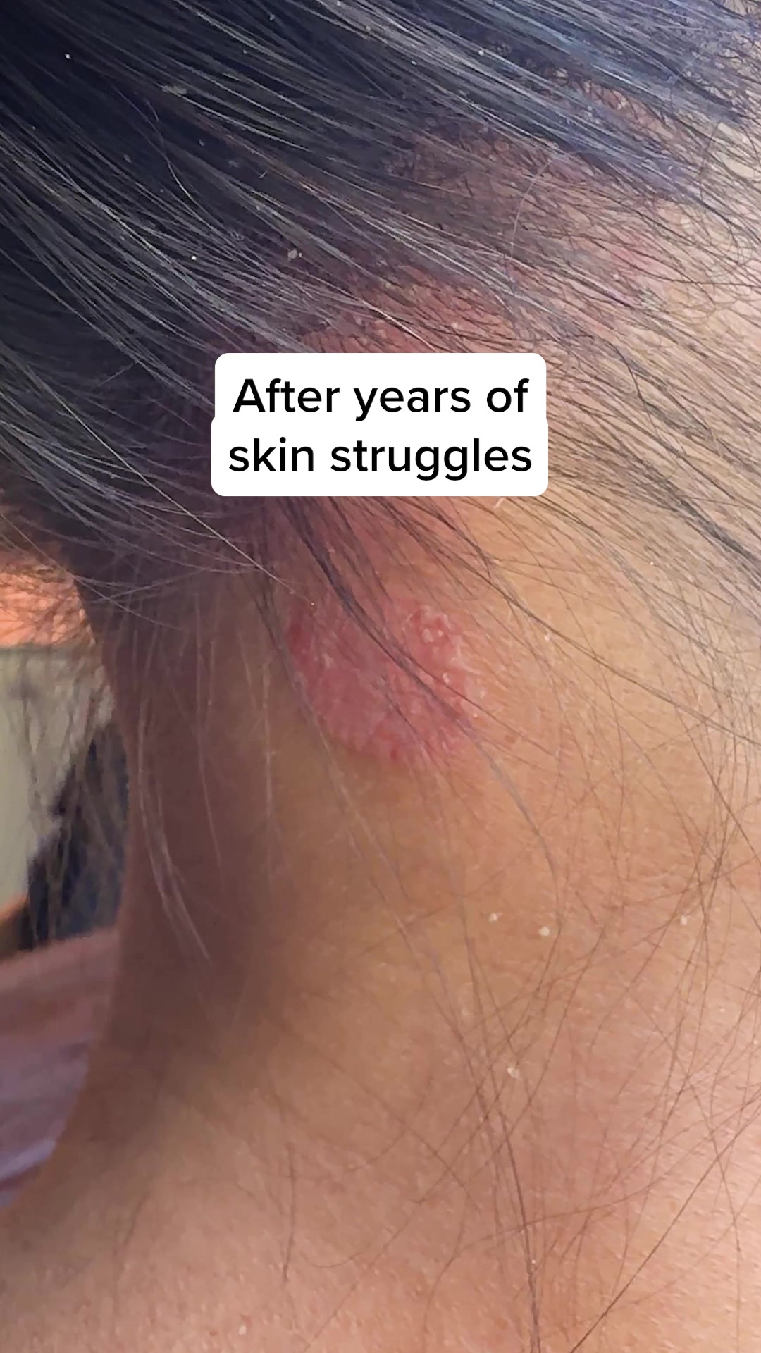 The Viking Secret to Healthy Skin