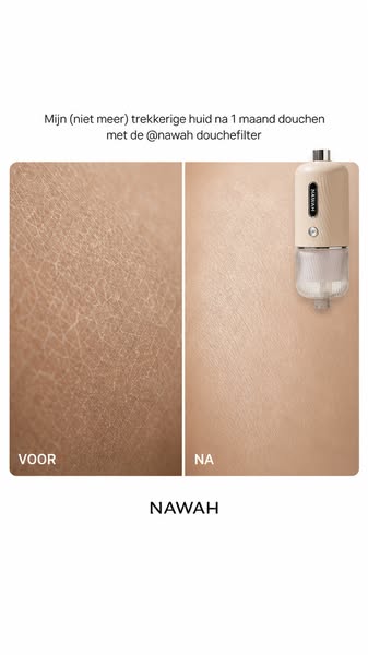 Dé oplossing tegen een trekkerige huid