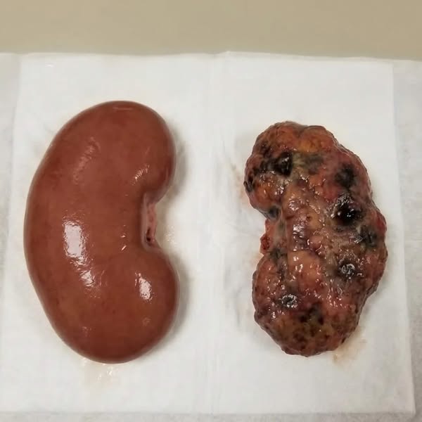 Ontdek vandaag nog de kracht van astaxanthine!