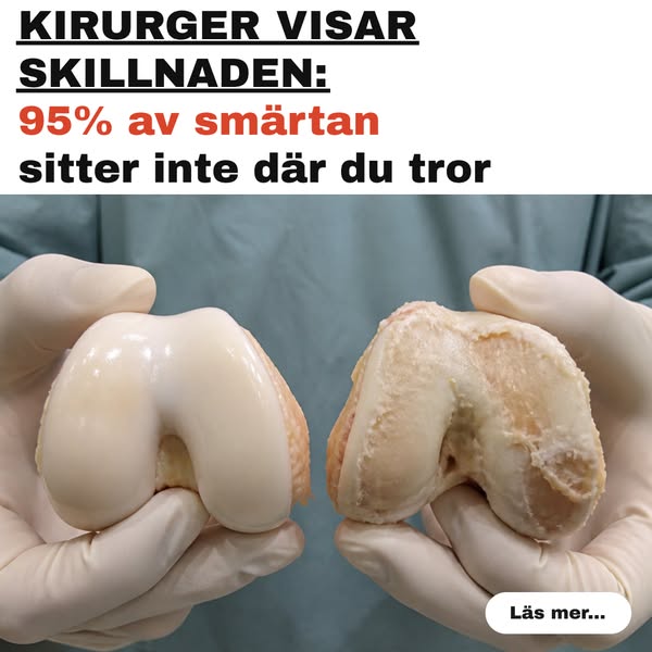 Kirurgen lägger två broskmodeller sida vid sida: är detta den verkliga orsaken till ledsmärta?