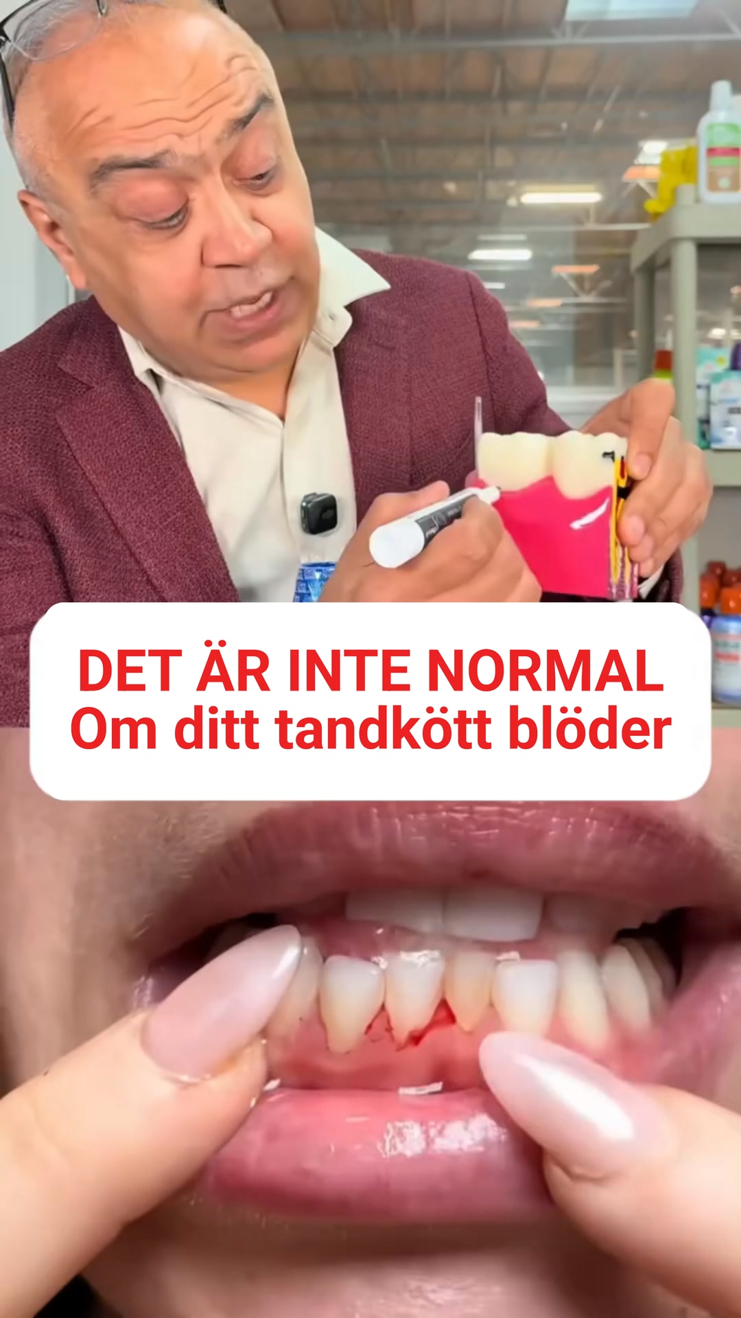 Satsa på ditt leendes hälsa på lång sikt