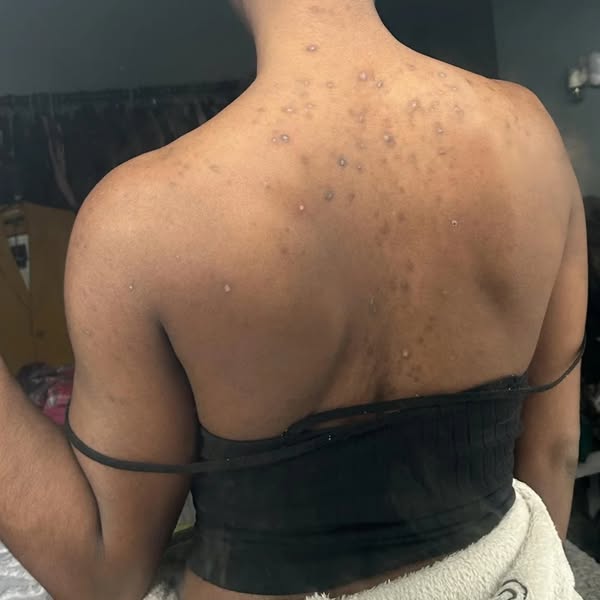I Accepted them as Permanent. I was Wrong.