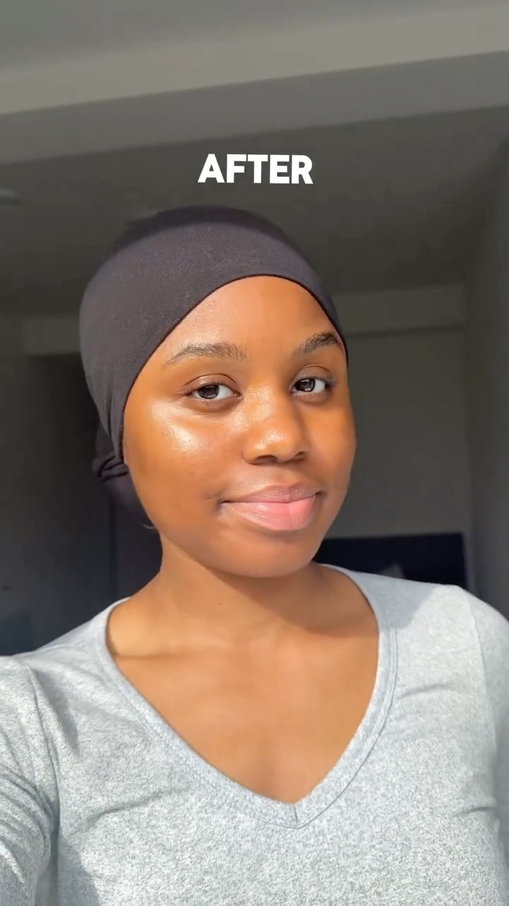Anúncio de GS skincare