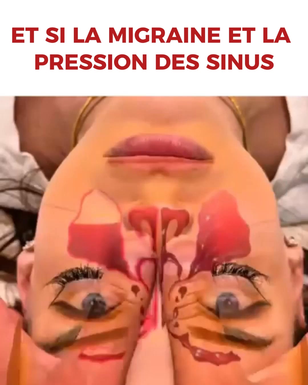 Pourquoi Vertiges, Tachycardie et Reflux Commencent Souvent dans le Cou
