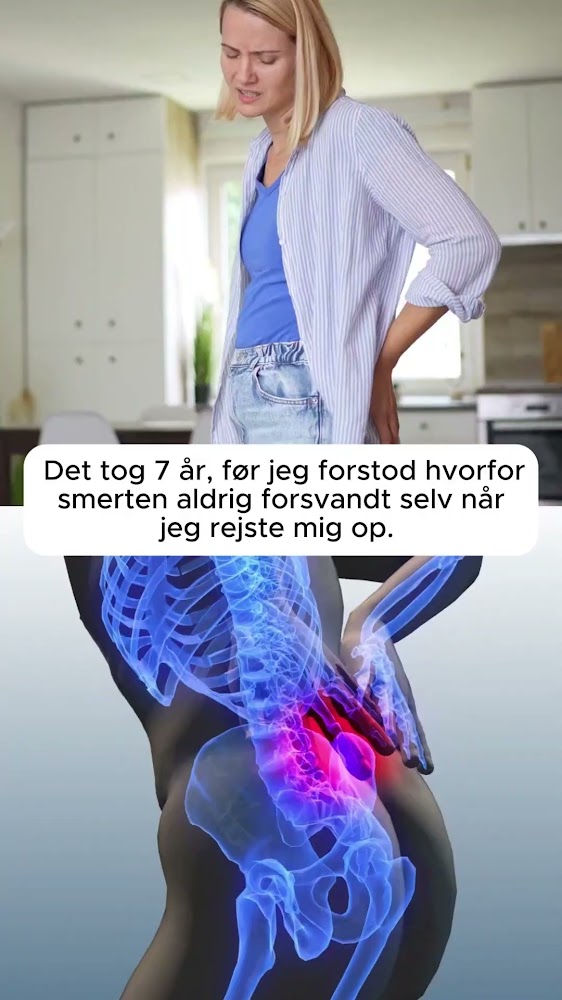 Når rygsmerter bliver en del af hverdagen