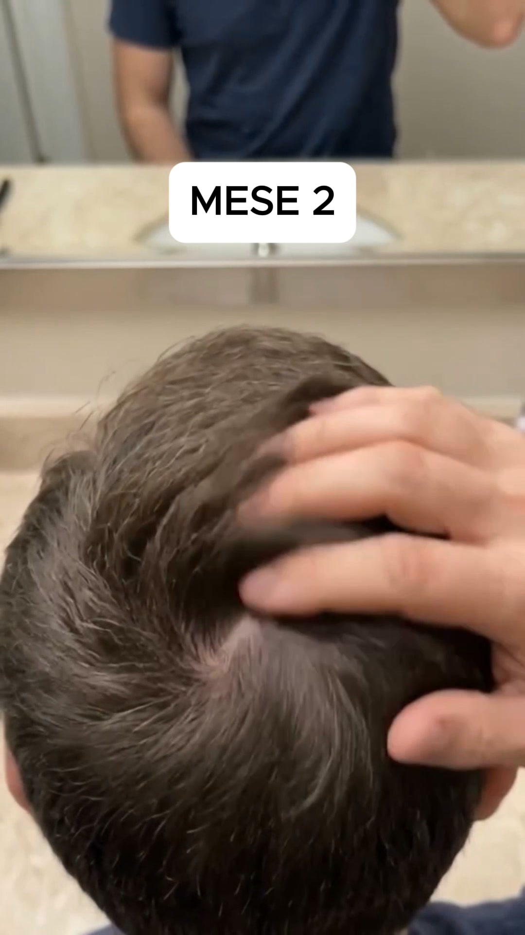 Il siero per la crescita dei capelli n. 1 in Corea