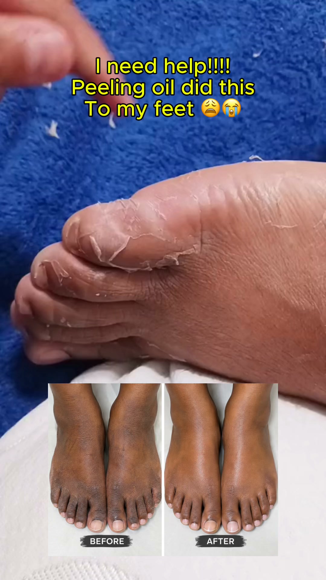 The Peeling Process People Keep Watching