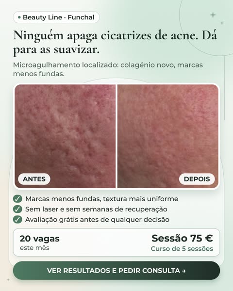 Vê os resultados reais no site