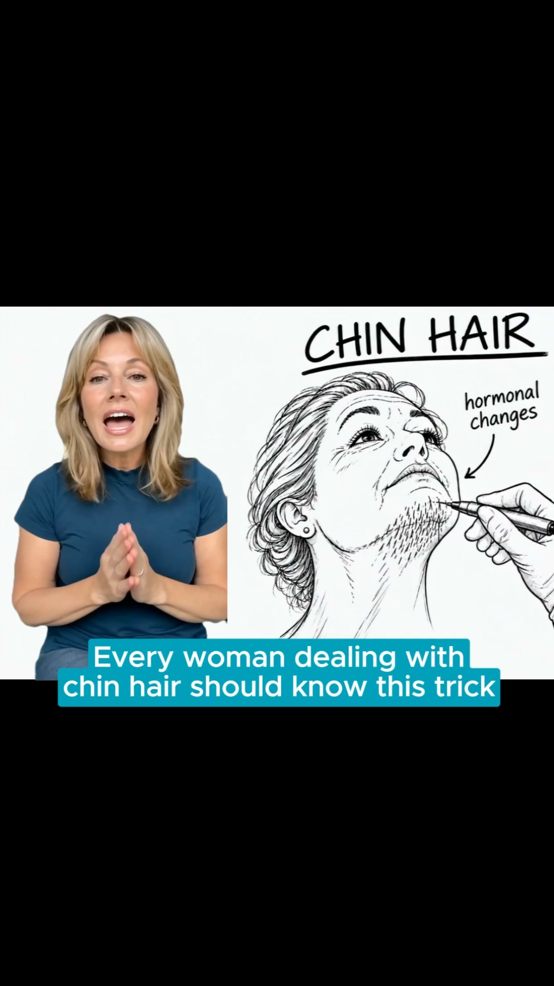 Still Dealing With Stubborn Chin Hair?