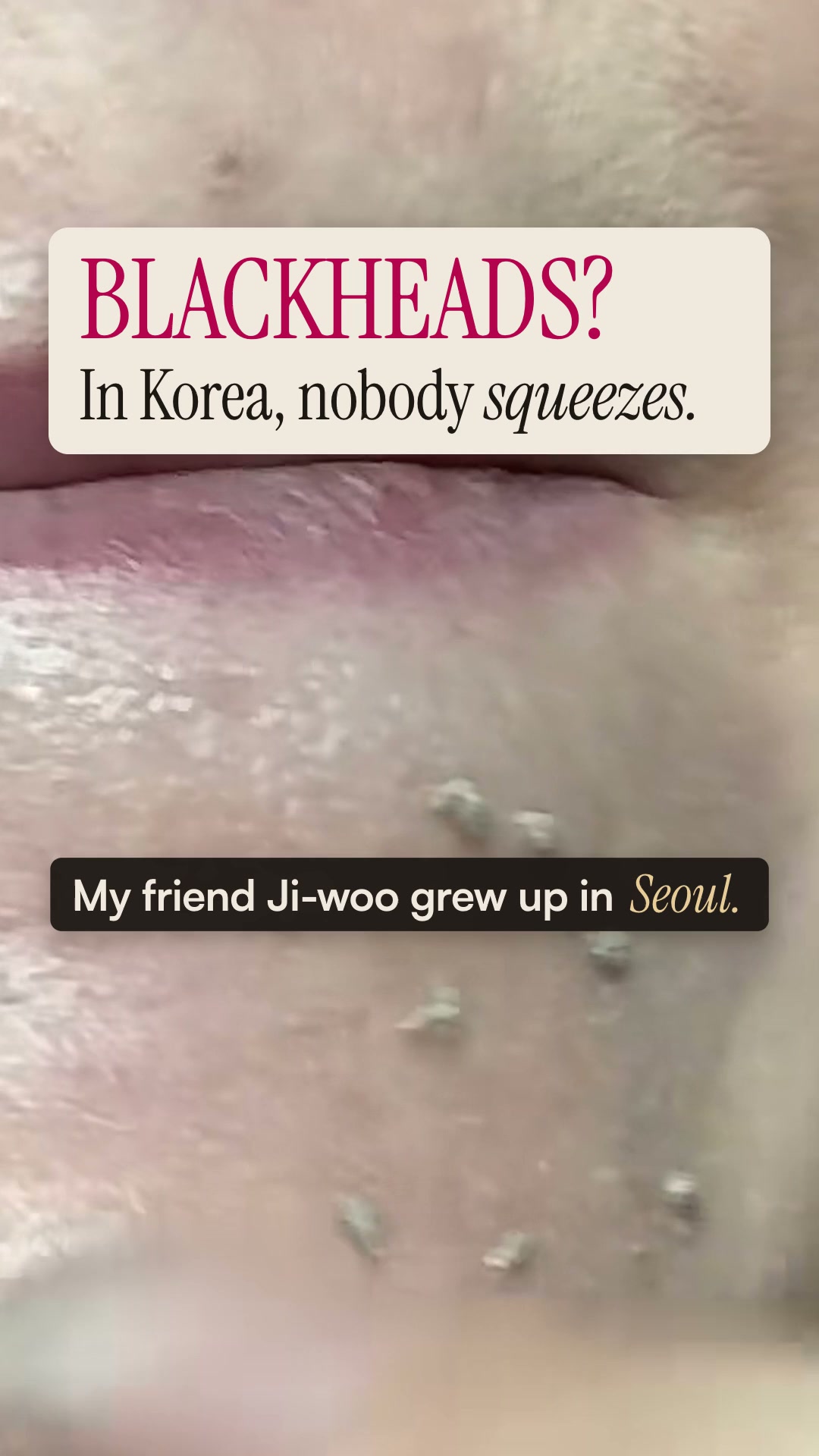 Say goodbye to blackheads