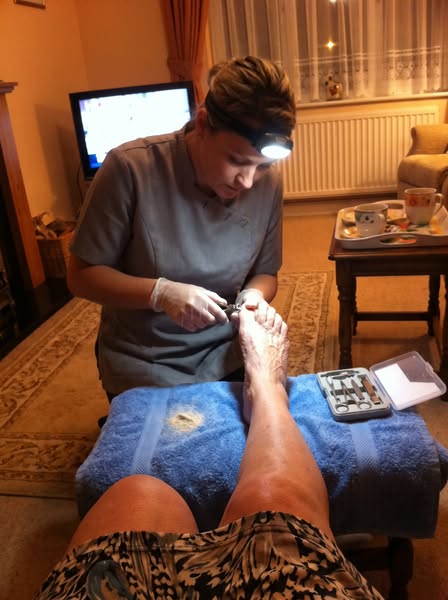 Read this if you have toe fungus