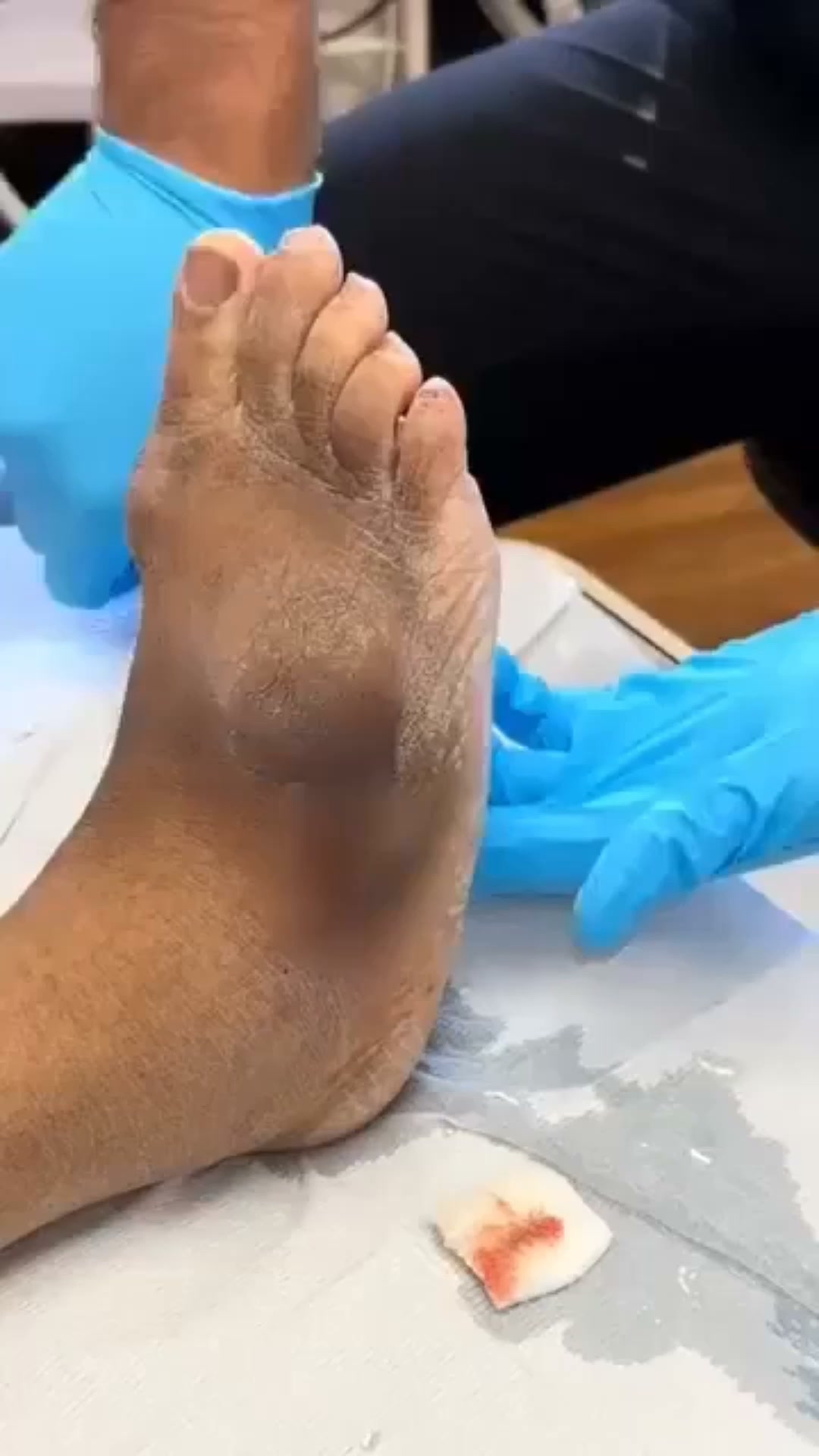¡Acaba con el dolor neuropático de una vez por todas!