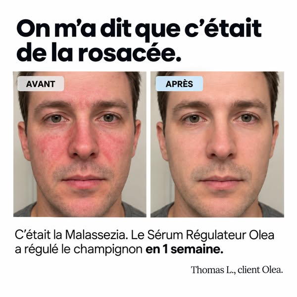 Pellicules, rougeurs, démangeaisons ? Agissez à la source.