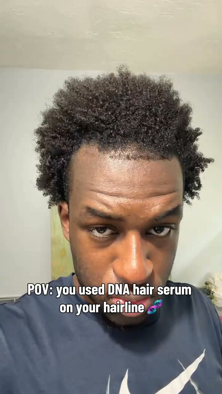 The serum that replaces minoxidil | 70% OFF Today
