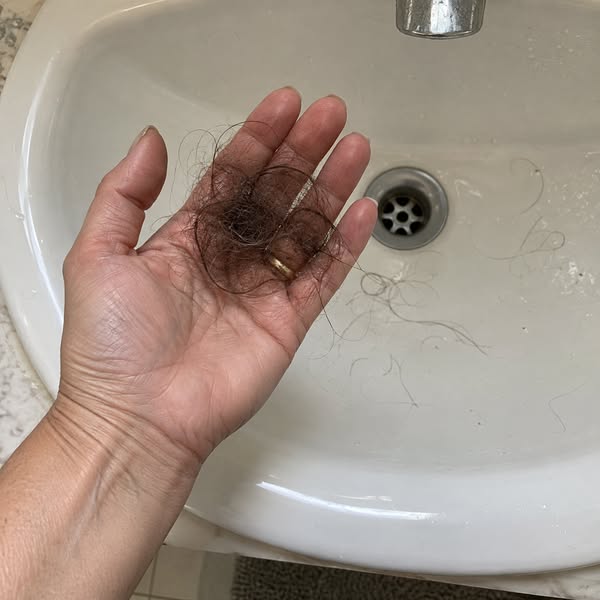 It's Not Your Age. It's 30 Years Of Shampoo