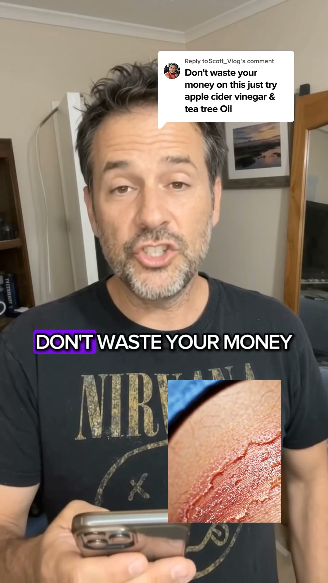 Stop The Itch