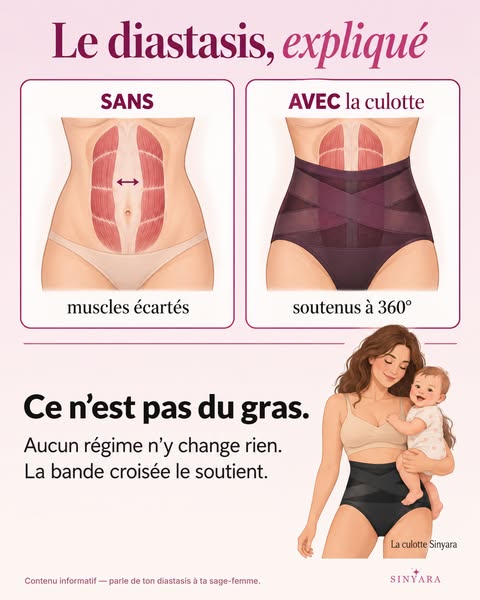 Le diastasis, expliqué
