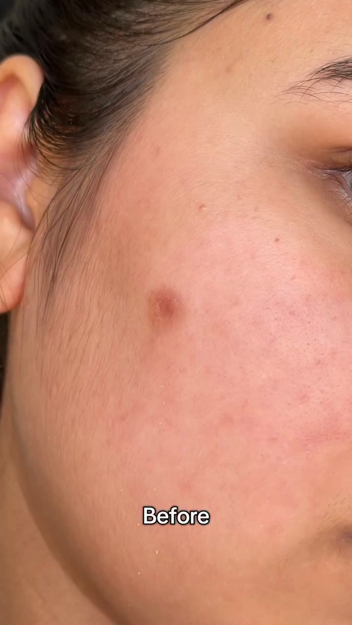 5 reasons this cream works when others didn't.