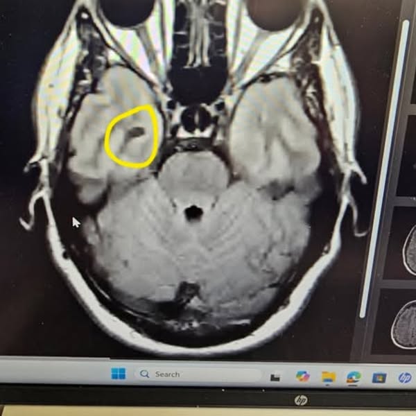 Why Movement Keeps Slipping While Scans Stay Stable