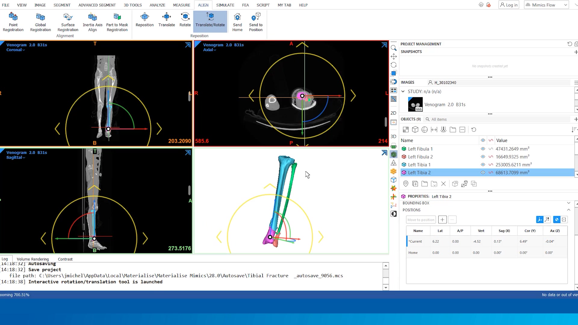 Accelerated 3D Planning