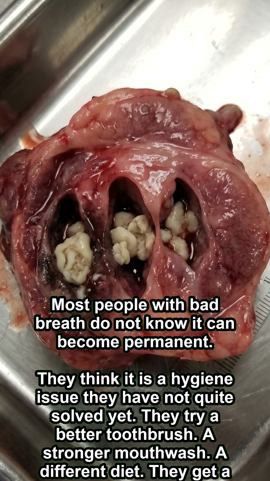 To people who have great hygiene and still can't get rid of bad breath — here's why nothing has worked.