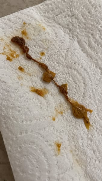 I Hadn’t Gone to the Bathroom in 9 Days