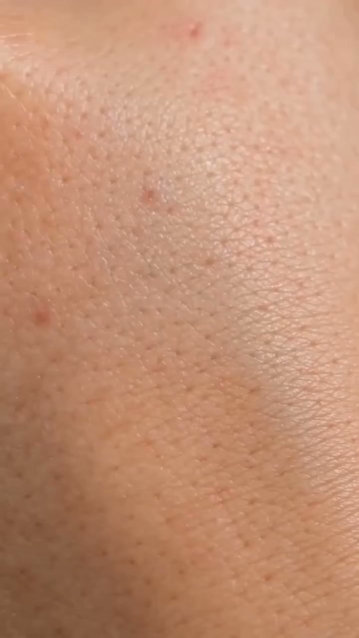 Celebrity-Approved Glow Treatment