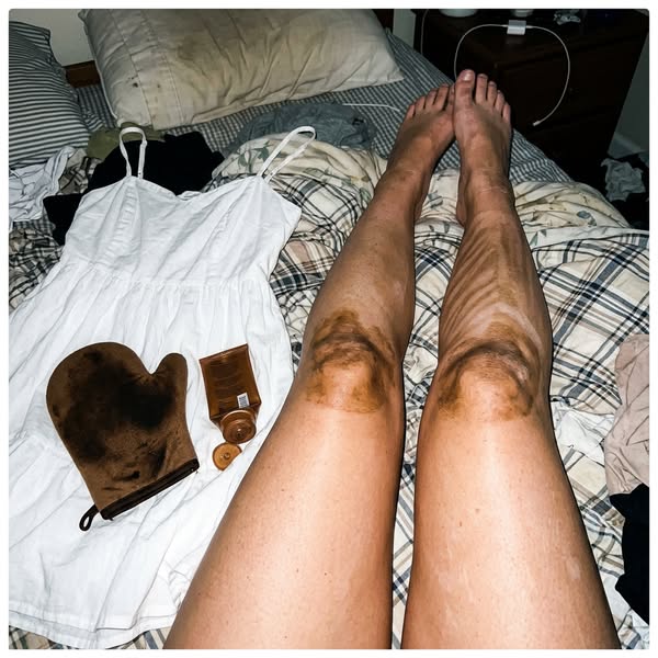 Je voulais bonne mine, j'ai fini avec des jambes zébrées...