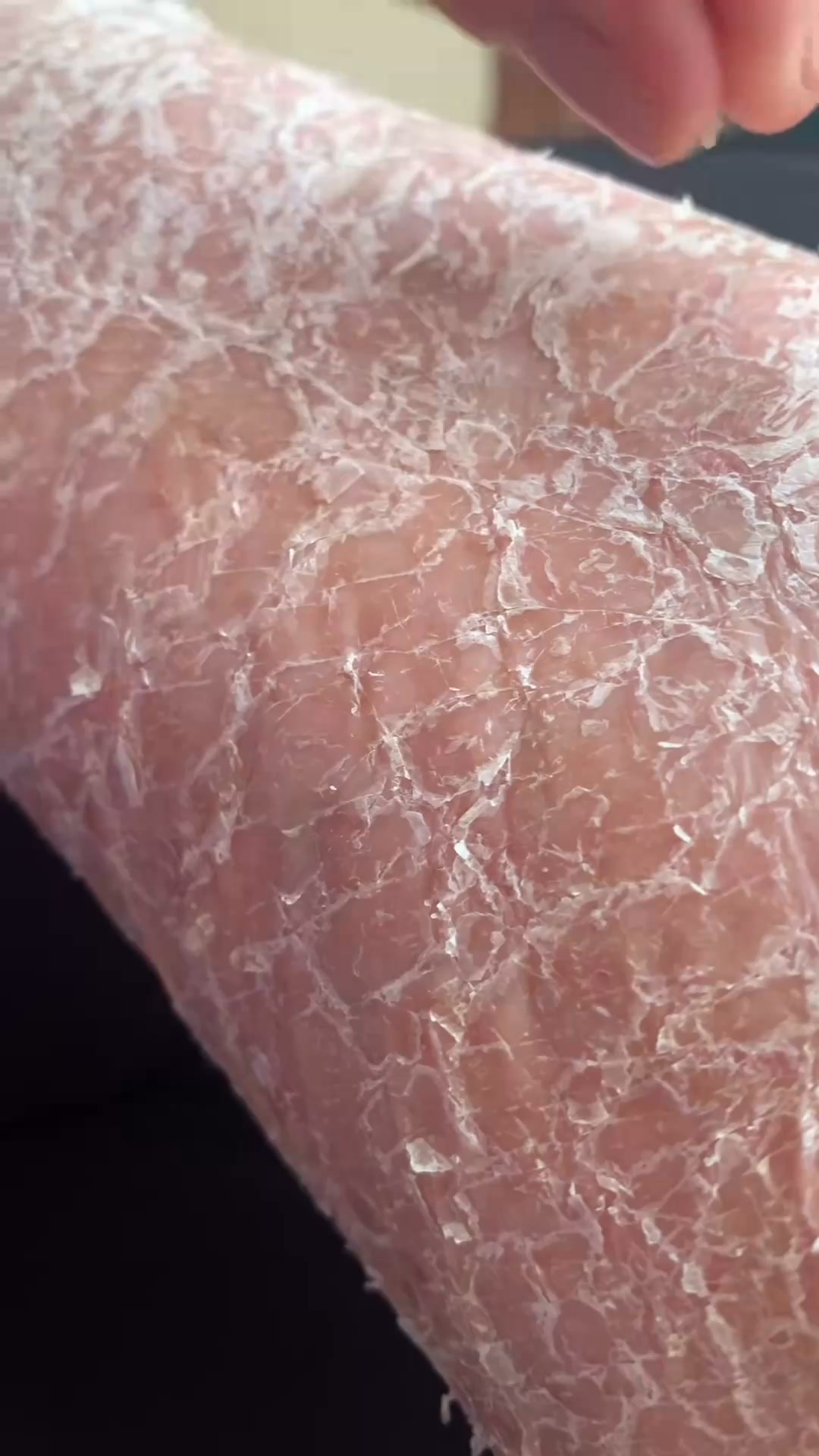Work With Your Skin