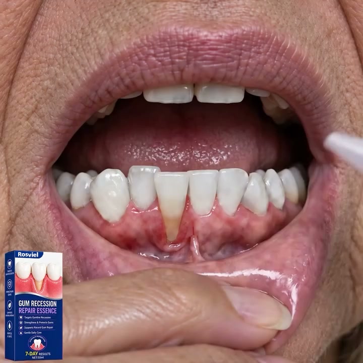 Rosviel® GumRevive Periodontal Care Gel